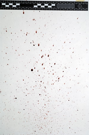 a bloodstain pattern that was created by an object striking a blood source below and in front of the veritical surface