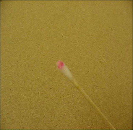 characteristic color of a positive reaction indicating the presence of blood