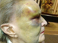 Photo of crime victim 84-year-old Sally.